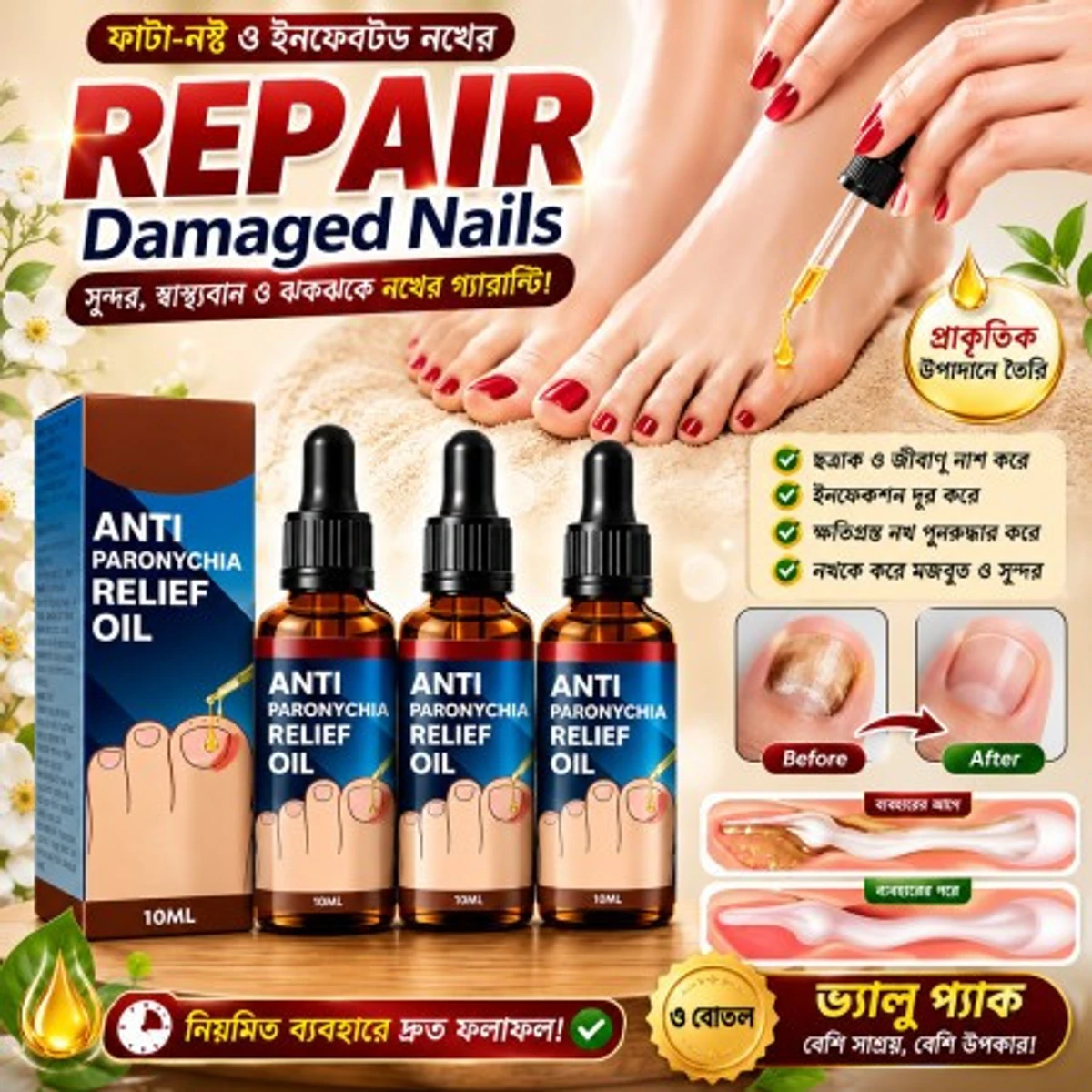 1 pcs Jaysuing Anti Paronychia Relief Oil 10 ml